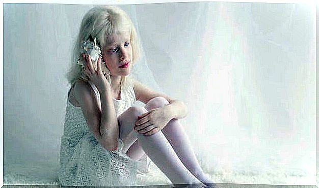 girl representing albino people