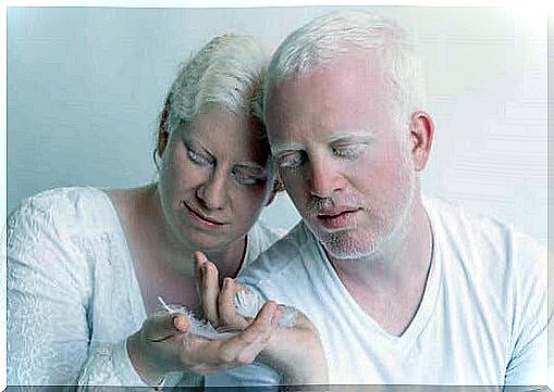 albino couple