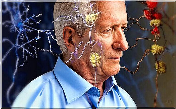 Older man with Alzheimer's